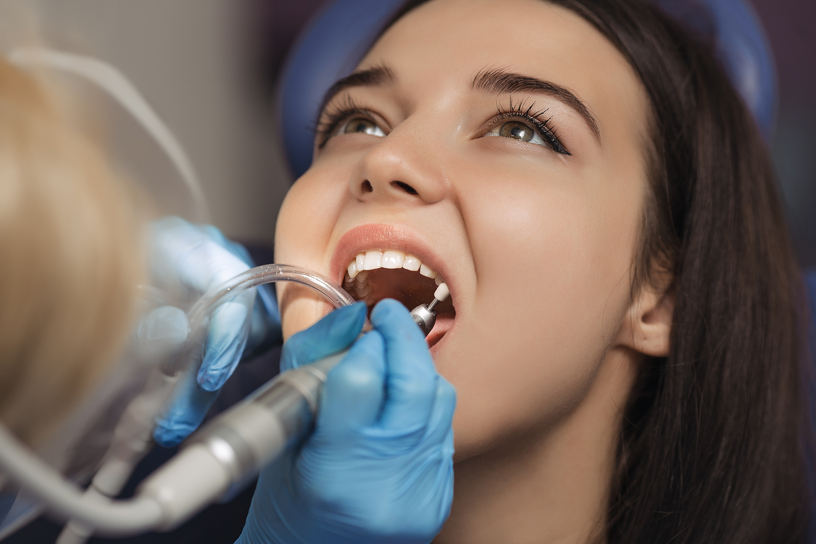 Benefits of Dental Implants: Why They’re Worth It