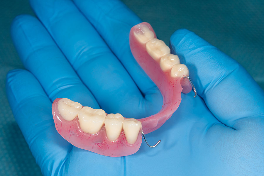 Improve Your Smile and Functionality with Partial Dentures in Los Gatos, CA